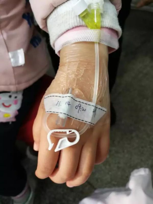 警惕留置针的4大潜在威胁严重的可危及生命